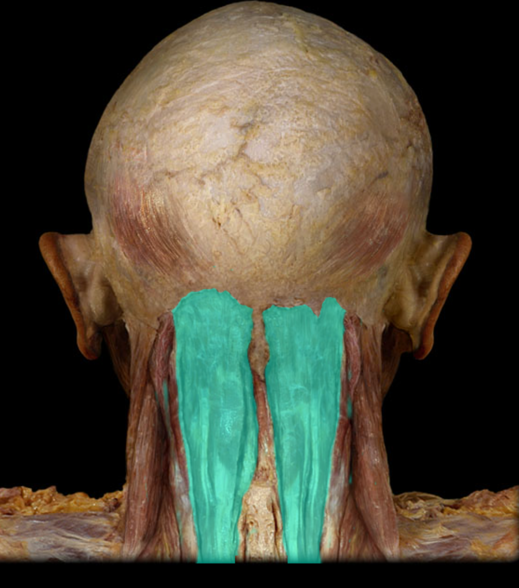 <p>Action:</p><ul><li><p>Unilateral: rotation of head to opposite side</p></li><li><p>Bilateral: extension of head and neck</p></li></ul><p>Origin:</p><ul><li><p>Transverse processes of C7-T6 vertebrae</p></li></ul><p>Insertion:</p><ul><li><p>Occipital bone</p></li></ul><p>Innervation:</p><ul><li><p>Cervical spinal nerves (dorsal rami)</p></li></ul><p></p>