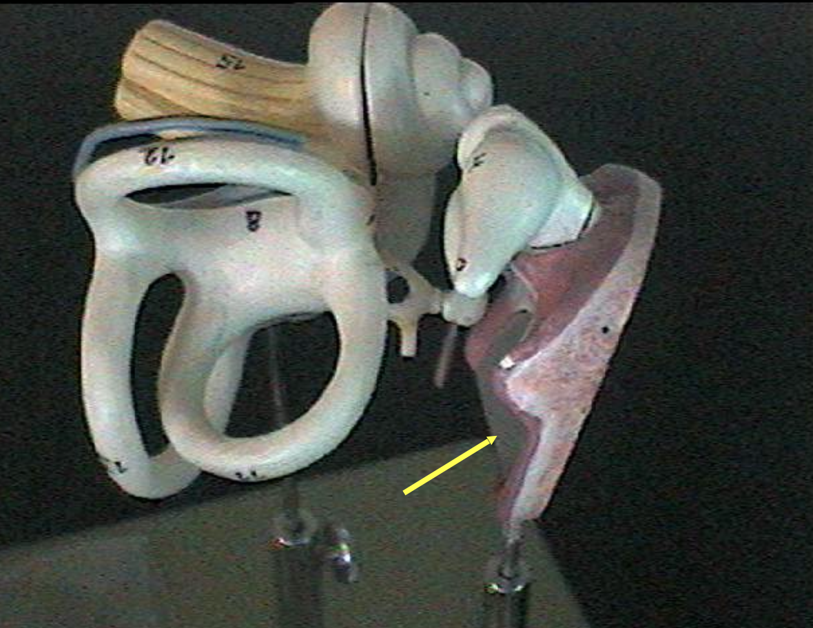 <p>Identify the ear parts. </p>