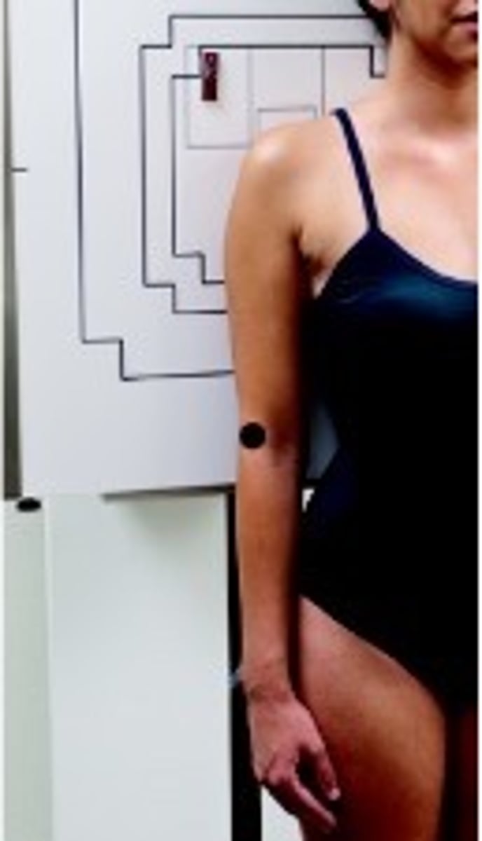 <p>S - around waist</p><p>T - 7 mAs @ 70 kVp</p><p>A - none</p><p>M - correct marker above shoulder</p><p>P - PT stands w/ back to board & arm hanging naturally, CR 1" below coracoid</p><p>S - 40"</p><p>B - suspension</p><p>C - 10 x 12 crosswise</p>