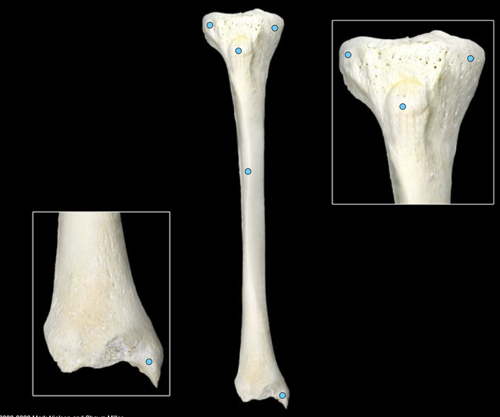 <p>medial bone of lower leg</p>