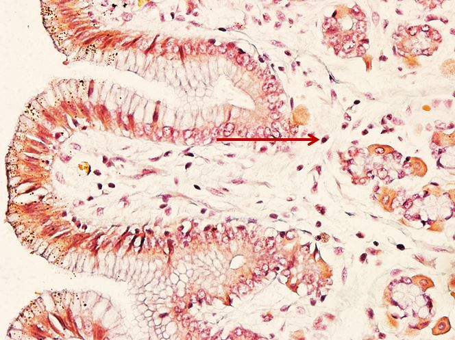 <p>Tế bào gì ?</p>