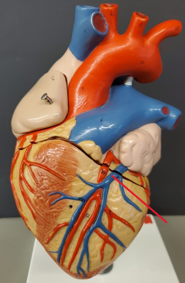 <p>Name the vein</p>