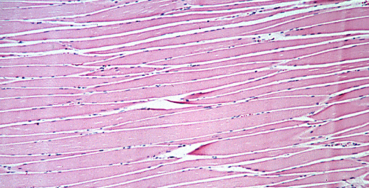 <ul><li><p>striated </p></li><li><p>cylinder cell shape </p></li><li><p>multi-nucleated </p></li><li><p>nuclei located under the sarcolemma </p></li></ul><p></p>