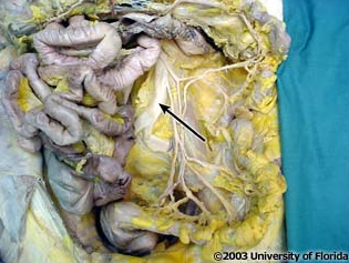<p>what structure is pictured (context, loops of the small intestine have been removed)</p>