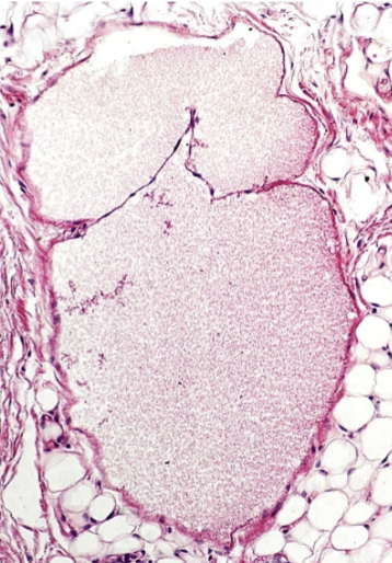 <p>What is this an image of?</p>