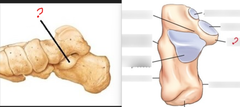 <p>Means "support for the talus", Located on the medial proximal aspect</p>