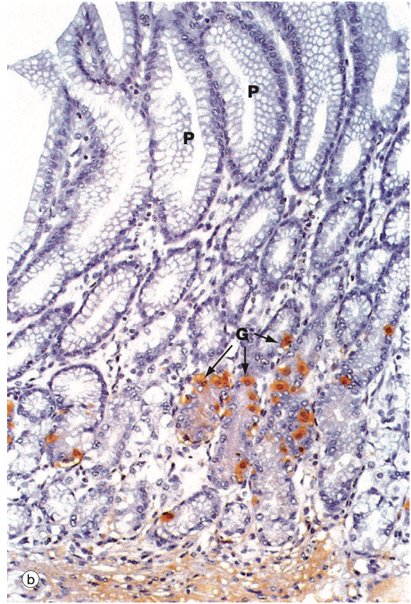 <p>What area of the stomach is this?</p>