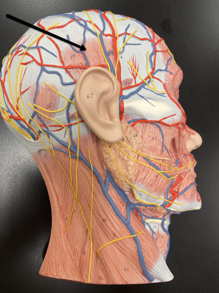 <p>Identify the muscle indicated by the pointer.</p>