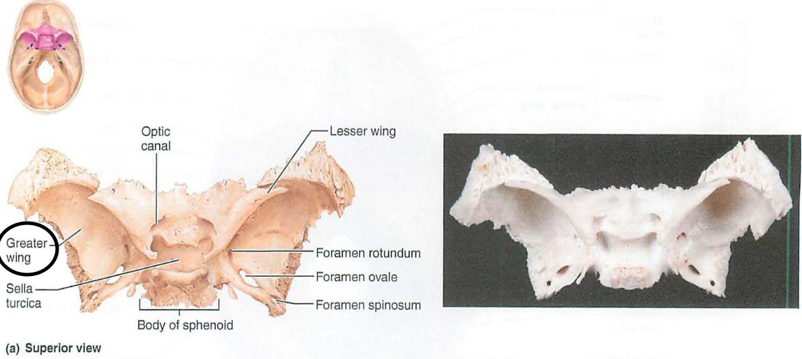 <p>project laterally from the sphenoid body forming parts of the middle cranial fossa and the orbit</p>