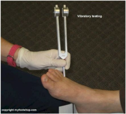 <p></p><ul><li><p>Tuning fork is placed on a bony prominence</p></li><li><p>Ask the patient if they can feel the vibration</p></li><li><p><em>Not often really used</em></p></li></ul><p></p>
