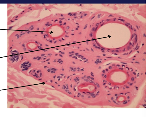 <p>Which is primary, which is secondary</p>
