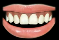 <p>A high smile line is present in 10.57% of the population. What does it reveal?</p>