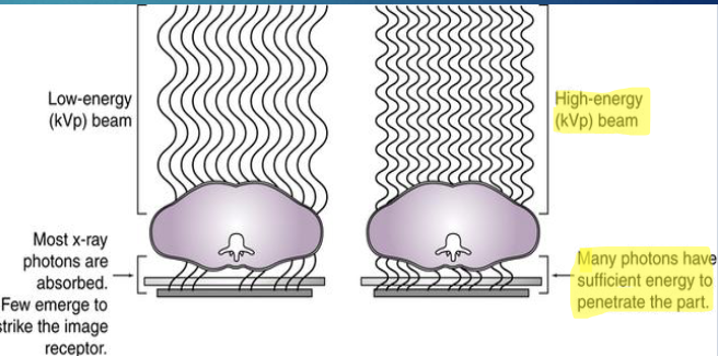 <p>kVp = energy of xrays</p><ul><li><p>more kVp improves image quality but reduced contrast</p></li></ul><p></p>