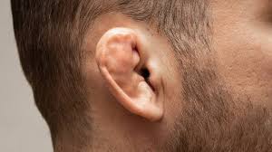 <p>blunt force trauma/ repeated friction to the outer ear which causes a blood clot to form between the skin and cartilage cutting off nutrients to the cartilage causes it to harden, scar and deform</p>