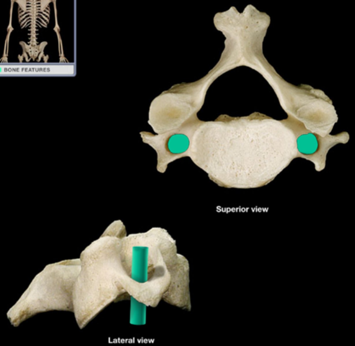 <p>Passage for arteries to brain, sides holes</p>