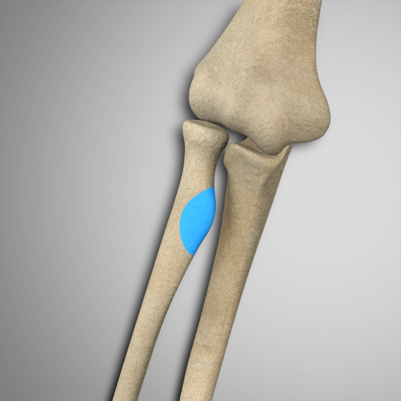 <p>A projection on the radius bone.</p>