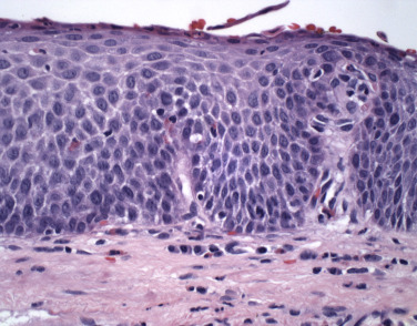 <p>What type of tissue is depicted in the image?</p>