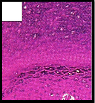 <p>MANY layers (stratified) of flat-shaped (squamous) cells in THICK SKIN</p>