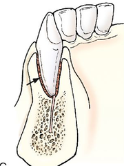 <p>peg in socket; no motion (ex. tooth in socket)</p>