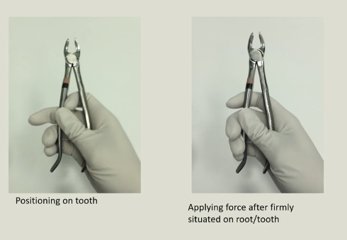 <p>holding forceps </p>