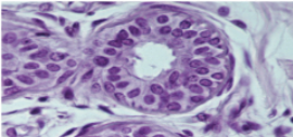 <p>Slide 6</p>
