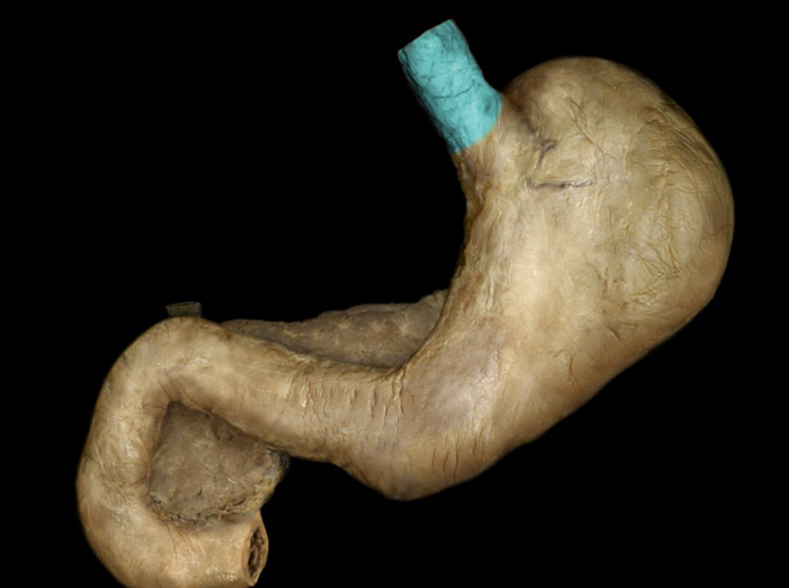 term image