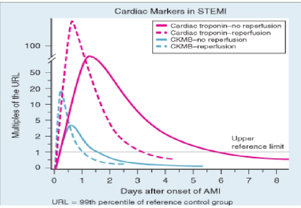 <ul><li><p>rapidly and higher peak of cardiac marker after successful reperfusion therapy</p></li></ul><p></p>