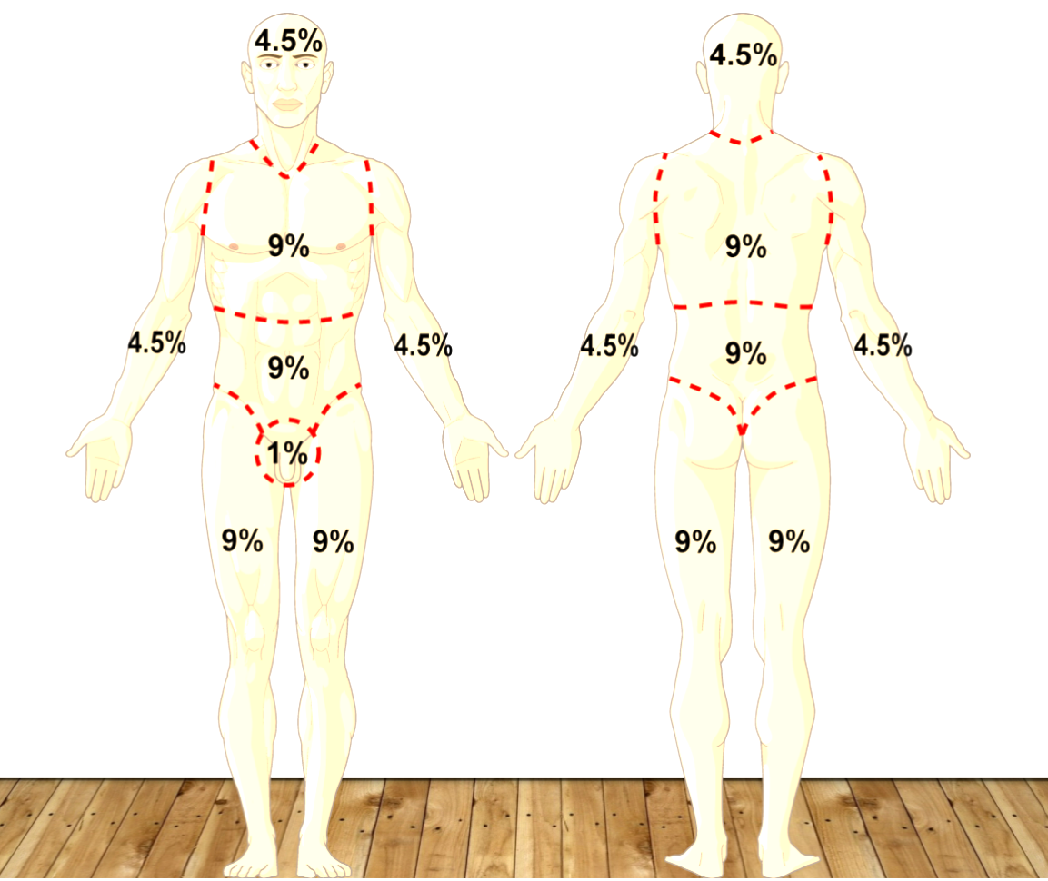 <p>total head 9% (4.5% front and 4.5% back)</p><p>total back 18%</p><p>total chest/abdomen 18%</p><p>total each arm 9% (4.5% front and 4.5% back)</p><p>total each leg 18% (9% front and 9% back)</p><p>premium 1%</p>