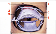 <p>what structure is 3?</p><p>attaches to the posterior lacrimal crest.</p>