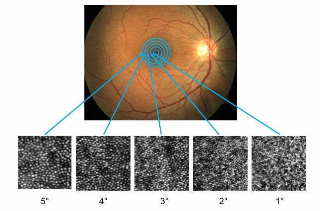 <p>fovea - cells are really small and packed</p><p>Progressively get larger and less densely packed</p>