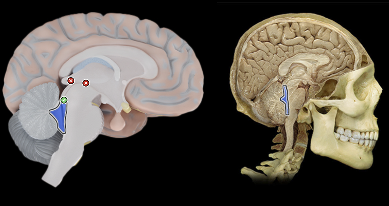 <p>What is labeled?</p>