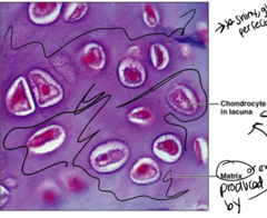 <p>What type of connective tissue is this?</p>