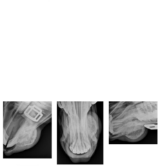 <p>Describe Conclusions: Give your radiographic diagnosis and list possible differential diagnoses for all your findings</p>