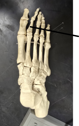 <p>Name Tarsal Bone</p>