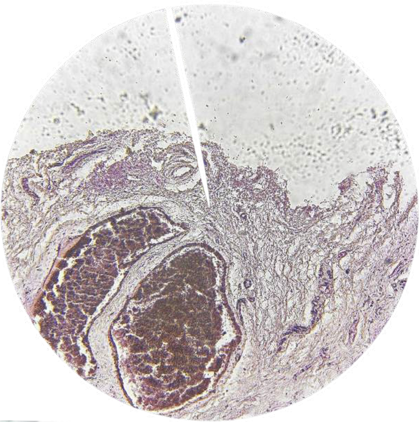 <p>Identify</p>