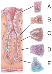 <p>d</p><p>—</p><p><span style="background-color: transparent;">A (<strong>Surface mucous cell</strong> – secretes mucus)</span></p><p><span style="background-color: transparent;">B (<strong>Mucous neck cell</strong> – secretes mucus)</span></p><p><span style="background-color: transparent;">C (<strong>Parietal cell</strong> – secretes hydrochloric acid and intrinsic factor)</span></p><p><span style="background-color: transparent;">D (<strong>Chief cell</strong> – secretes pepsinogen and gastric lipase)</span></p><p><span style="background-color: transparent;">E (Enteroendocrine cell – secretes the hormone gastrin)</span></p>