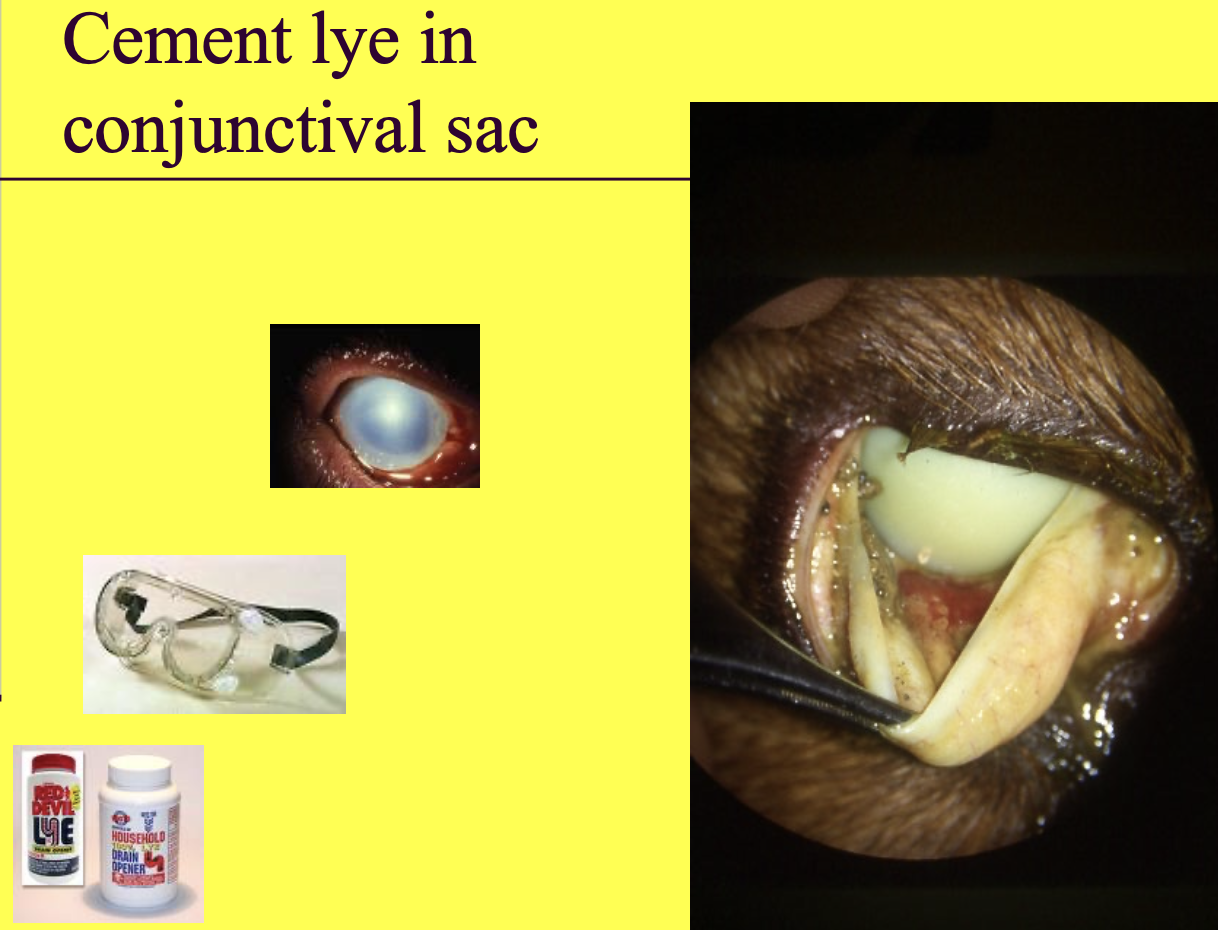 <p>causes severe adhesions</p>