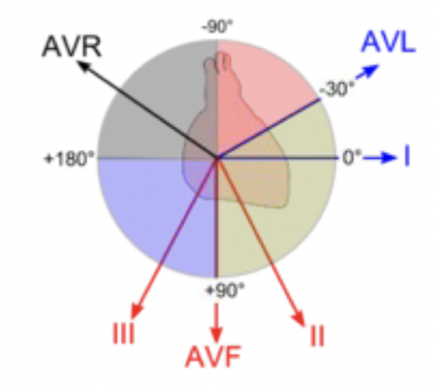 <p>normaal: -30 en +90 graden</p><ul><li><p>positieve afleiding I en positieve afleiding aVF</p></li><li><p>afleiding I positief, afleiding aVF negatief: check afleiding II → deze positief, dan normale hartas</p><ul><li><p>afleiding II negatief → dan is het een linkerhartas</p></li></ul></li></ul><p></p><ul><li><p>afwijkende hartas</p><ul><li><p>afl. I neg + afl. aVF pos: rechterhartas (> + 90<span>°)</span></p></li><li><p>afl. I neg + afl. aVF neg: extreme hartas (-90<span>° tot - 180°)</span></p></li></ul></li></ul><p></p>