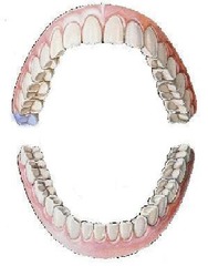 <p>maxillary right third molar</p>