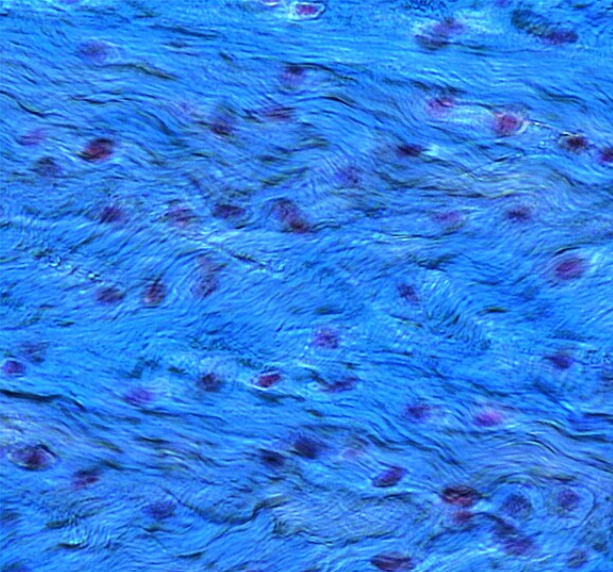 <p>what tissue is this? </p>