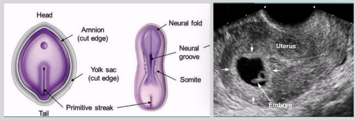 <ul><li><p><span style="background-color: transparent;">Formed from proliferation and movement of epiblast cells to the median plane of embryonic disc</span></p></li><li><p><span style="background-color: transparent;">Once it appears, can identify embryo’s craniocaudal axis</span></p></li></ul><p></p>