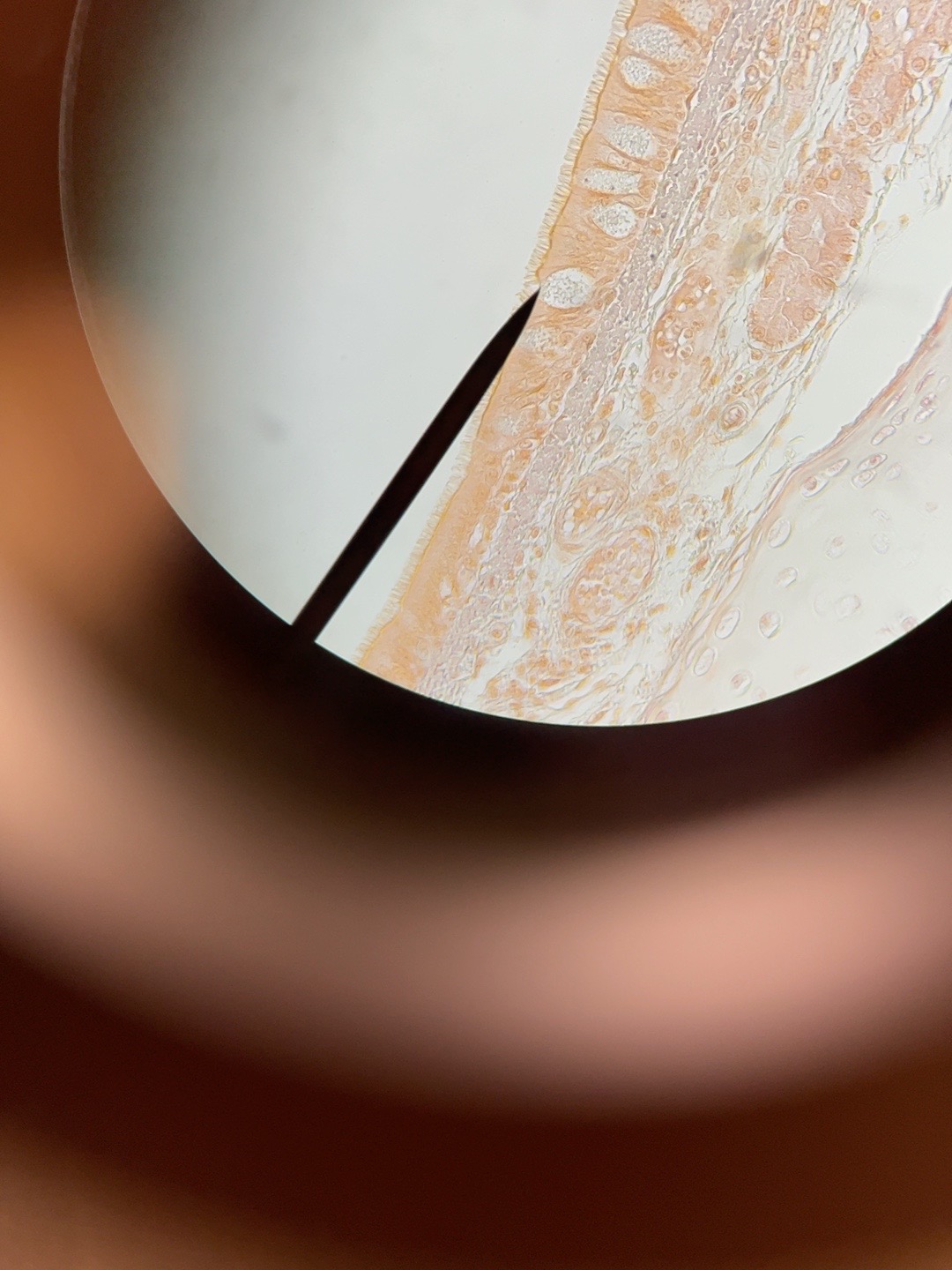 <p>What type of Epithelium Tissue is this ?</p>