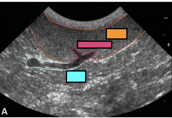 <p>what structure is outlined in pink?</p>