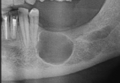 <p>Describe the characteristics of this lesion: (4)</p>