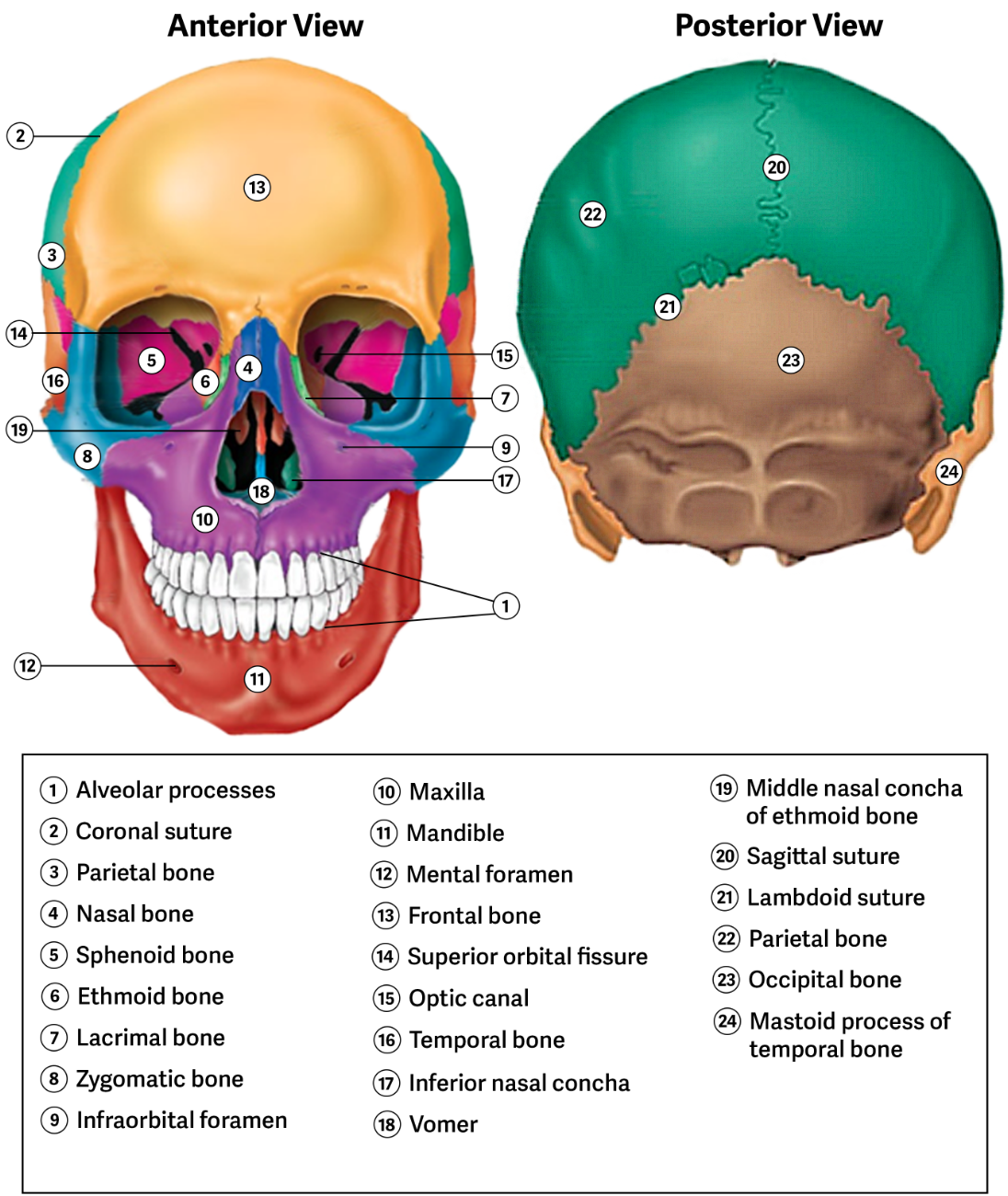 <p>Synostosis </p>