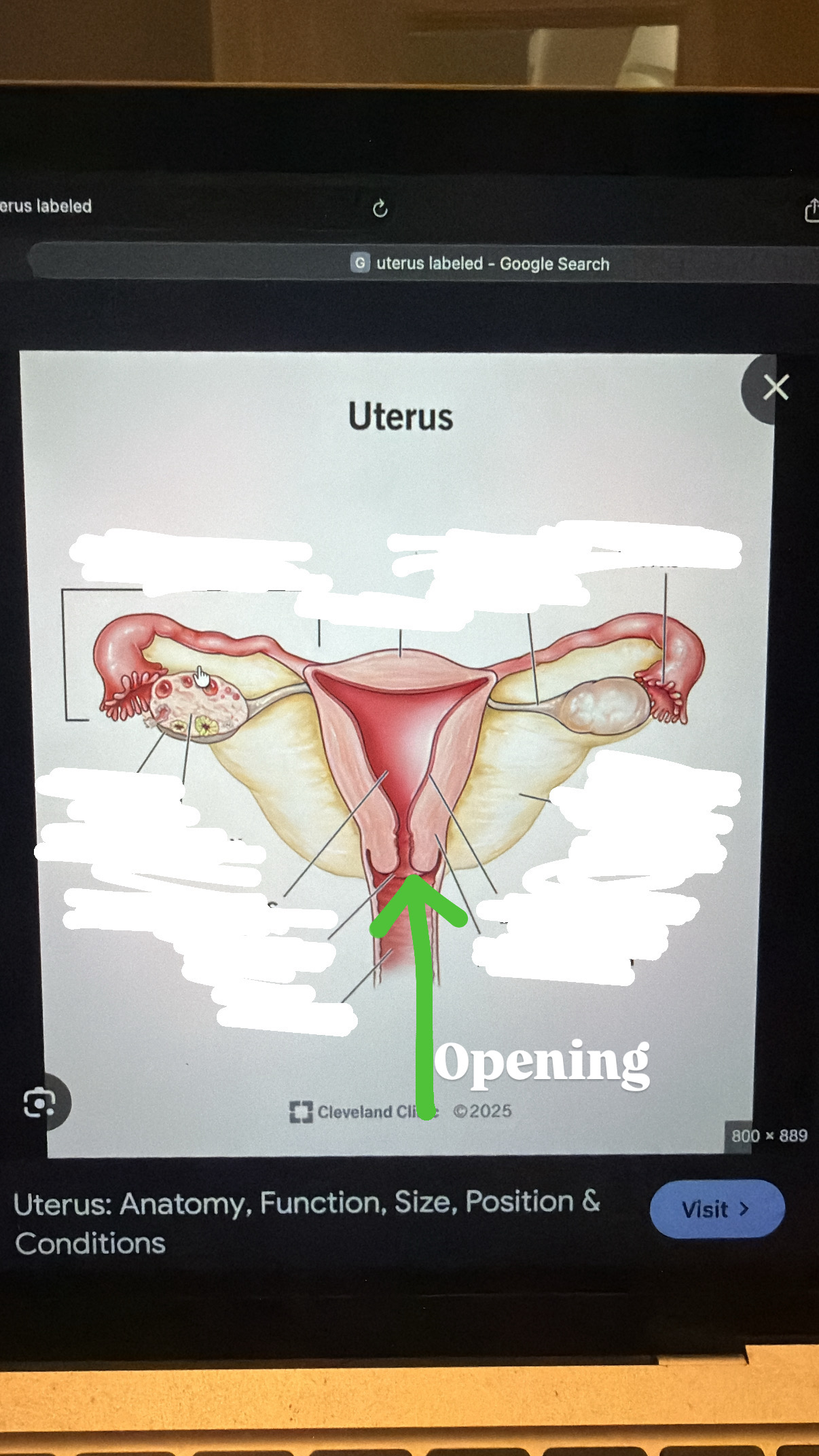 <p>opening to the vagina, bottom of the cervix</p>