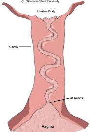 <p>“Cork screw”</p><ul><li><p>Sow cervix has many interdigitating pads</p></li><li><p>Sow  does NOT have fornix vagina</p></li></ul><p></p>