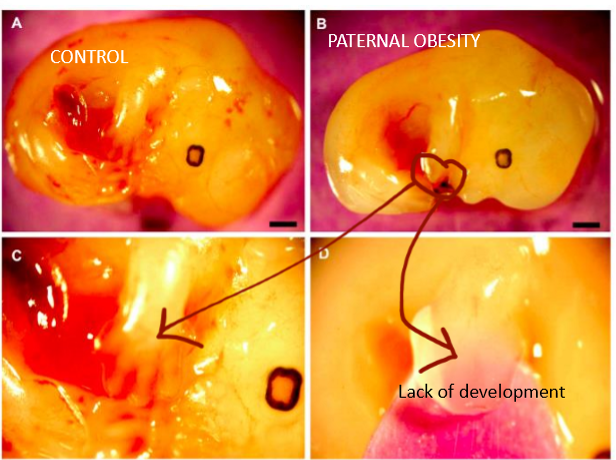 <p>slow development, shown is lack of interdigitation </p>