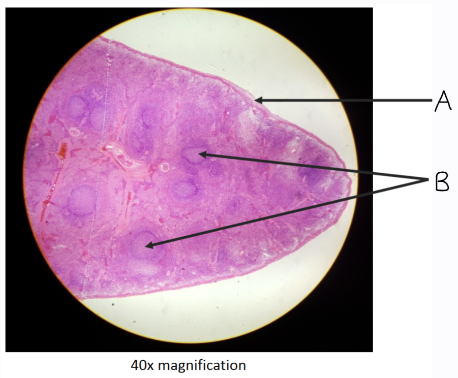<p>What organ tissue is this? What is A &amp; B ?</p>
