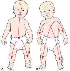 <p>A quantitative increase in size or body mass that determines the health and nutrition of the child</p>